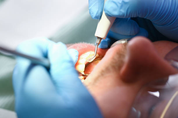 Best Emergency Dental Surgery in Flower Hill, MD